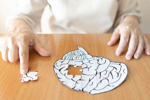 Most Common Causes of Alzheimer's in 2019